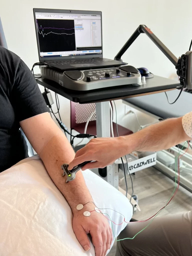 Radial Sensory Nerve NCV 2