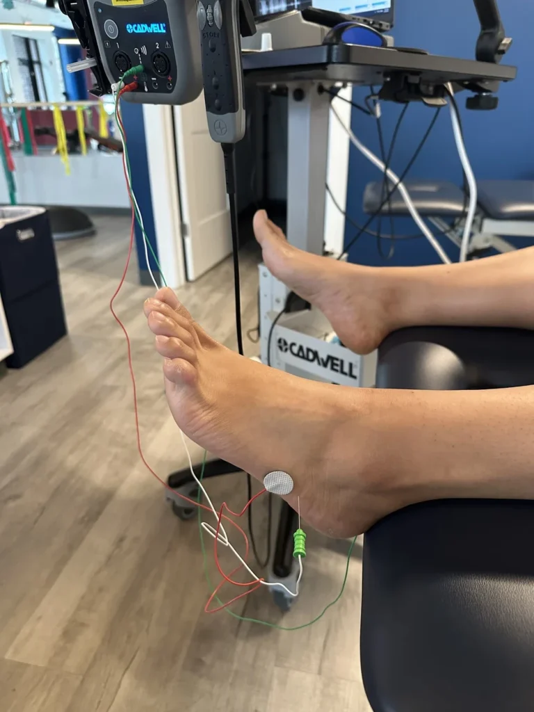 nerve conduction test on foot with electrodes attached Chicago clinic
