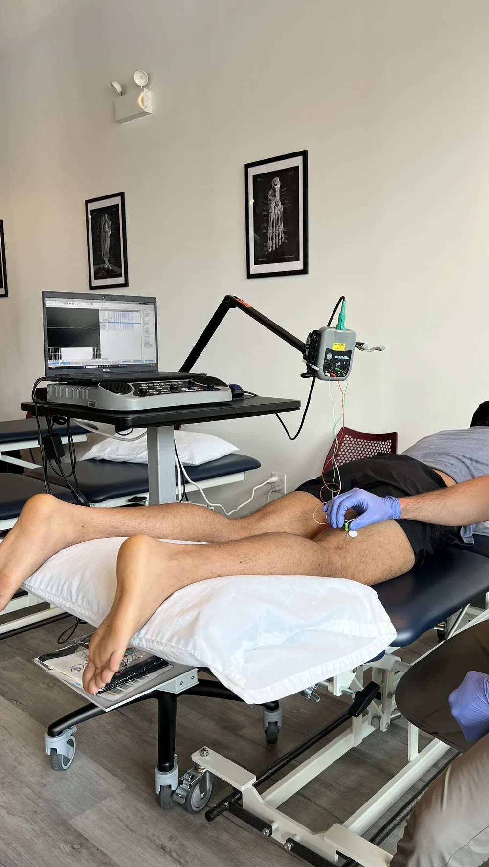 EMG testing procedure on patient leg at neuromuscular diagnostics Chicago