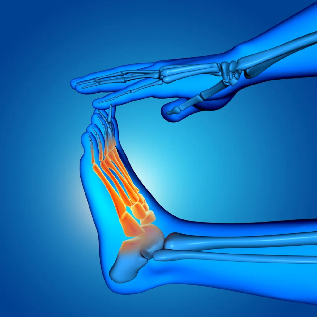 polyneuropathy multiple nerve damage diagnosed with EMG Chicago